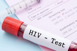 According to the Iowa Department of Public Health about a third of state residents living with HIV/AIDS are located in rural areas.